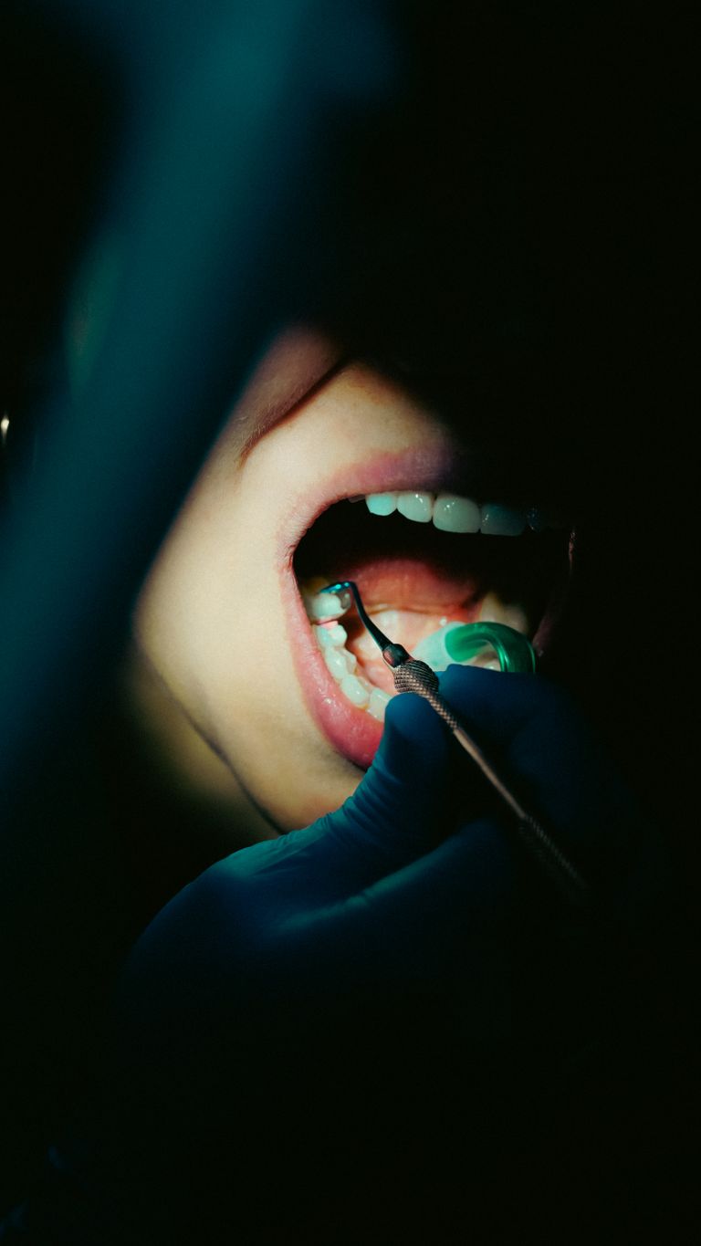 The MAR Legal Blog 11 Detailed close-up of a dental examination with dental tools, showcasing oral hygiene.